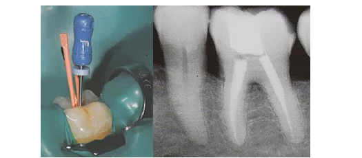οδοντιατρος αθηνα